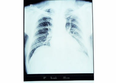 Film olographe d'imagerie médicale, film de l'ANIMAL FAMILIER X Ray d'imprimantes thermiques